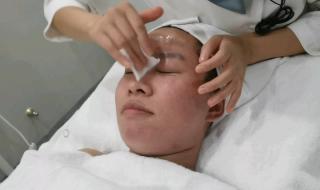 mts皮肤管理 mts皮肤管理